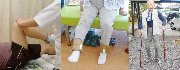 めいわはり灸接骨院訪問リハビリマッサージの機能訓練、歩行訓練